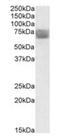 Tripeptidyl Peptidase 1 antibody, orb20271, Biorbyt, Western Blot image 