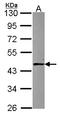 AlkB Homolog 1, Histone H2A Dioxygenase antibody, LS-C186395, Lifespan Biosciences, Western Blot image 