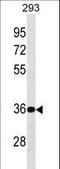 Biphenyl Hydrolase Like antibody, LS-C159180, Lifespan Biosciences, Western Blot image 
