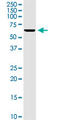 Potassium Voltage-Gated Channel Subfamily A Member 3 antibody, LS-C197569, Lifespan Biosciences, Western Blot image 