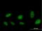 ATPase Family AAA Domain Containing 2 antibody, H00029028-B01P, Novus Biologicals, Immunocytochemistry image 