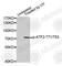 Activating Transcription Factor 2 antibody, AP0129, ABclonal Technology, Western Blot image 