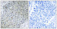 ETS Variant 4 antibody, abx013490, Abbexa, Western Blot image 