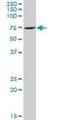 Zinc Finger Protein 257 antibody, H00113835-B01P, Novus Biologicals, Western Blot image 