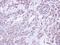 Glucosidase II Alpha Subunit antibody, LS-C185471, Lifespan Biosciences, Immunohistochemistry paraffin image 