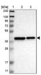 Transmembrane Protein 19 antibody, PA5-53500, Invitrogen Antibodies, Western Blot image 