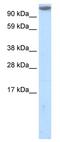 MKL/myocardin-like protein 1 antibody, ab49311, Abcam, Western Blot image 