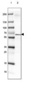 Inositol-3-Phosphate Synthase 1 antibody, NBP2-47415, Novus Biologicals, Western Blot image 