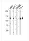 Lysosomal alpha-glucosidase antibody, LS-B10678, Lifespan Biosciences, Western Blot image 