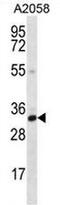 Calponin 2 antibody, AP50987PU-N, Origene, Western Blot image 