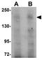 FERM And PDZ Domain Containing 3 antibody, GTX85235, GeneTex, Western Blot image 
