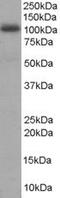 A-Kinase Anchoring Protein 8 antibody, PA5-18265, Invitrogen Antibodies, Western Blot image 