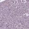 Phosphorylated Adaptor For RNA Export antibody, HPA070326, Atlas Antibodies, Immunohistochemistry paraffin image 