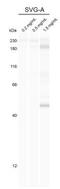 Histone Deacetylase 10 antibody, NB600-223, Novus Biologicals, Western Blot image 