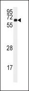 Calcium/Calmodulin Dependent Protein Kinase II Alpha antibody, PA5-14315, Invitrogen Antibodies, Western Blot image 