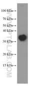 Clathrin Light Chain B antibody, 66270-1-Ig, Proteintech Group, Western Blot image 