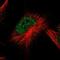 Autophagy Related 2B antibody, NBP1-90732, Novus Biologicals, Immunofluorescence image 