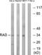 RAD antibody, A30715, Boster Biological Technology, Western Blot image 