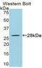 Receptor Interacting Serine/Threonine Kinase 3 antibody, LS-C296194, Lifespan Biosciences, Western Blot image 