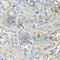 USH1 Protein Network Component Harmonin antibody, A4368, ABclonal Technology, Immunohistochemistry paraffin image 
