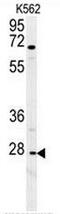 C-X-C Motif Chemokine Receptor 3 antibody, AP51144PU-N, Origene, Western Blot image 