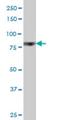 Ribosomal Protein S6 Kinase A6 antibody, H00027330-M03, Novus Biologicals, Western Blot image 