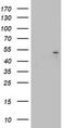 Keratin 20 antibody, LS-C338573, Lifespan Biosciences, Western Blot image 