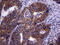 Thyroid Hormone Receptor Interactor 13 antibody, M06921, Boster Biological Technology, Immunohistochemistry paraffin image 