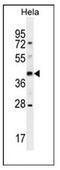 Olfactory Receptor Family 10 Subfamily H Member 4 antibody, AP53008PU-N, Origene, Western Blot image 