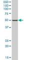 Pantothenate kinase 1 antibody, H00053354-B01P, Novus Biologicals, Western Blot image 