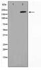 Microtubule Associated Serine/Threonine Kinase 2 antibody, TA347671, Origene, Western Blot image 