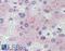 ATP Binding Cassette Subfamily B Member 4 antibody, LS-B4112, Lifespan Biosciences, Immunohistochemistry frozen image 