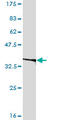 Eukaryotic Translation Initiation Factor 2B Subunit Beta antibody, LS-B6193, Lifespan Biosciences, Western Blot image 