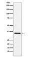 TNF Receptor Superfamily Member 10d antibody, M05136-2, Boster Biological Technology, Western Blot image 