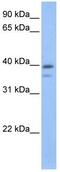 VPS26, Retromer Complex Component B antibody, GTX49354, GeneTex, Western Blot image 