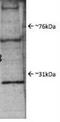Proteasome Subunit Beta 4 antibody, NBP1-54592, Novus Biologicals, Western Blot image 