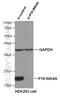 CDKN2A antibody, 10883-1-AP, Proteintech Group, Western Blot image 