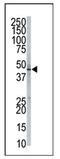 Phosphatidylinositol Glycan Anchor Biosynthesis Class K antibody, AP12208PU-N, Origene, Western Blot image 