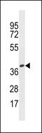 Olfactory Receptor Family 4 Subfamily X Member 1 (Gene/Pseudogene) antibody, 59-984, ProSci, Western Blot image 