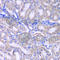 Regulator Of Microtubule Dynamics 3 antibody, A5820, ABclonal Technology, Immunohistochemistry paraffin image 