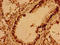 Vesicle Associated Membrane Protein 7 antibody, LS-C318981, Lifespan Biosciences, Immunohistochemistry paraffin image 