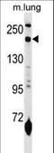 Mannose Receptor C-Type 1 antibody, LS-B9805, Lifespan Biosciences, Western Blot image 