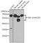 Hepatitis A Virus Cellular Receptor 2 antibody, GTX54117, GeneTex, Western Blot image 