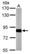 NADH:Ubiquinone Oxidoreductase Core Subunit S1 antibody, NBP1-31142, Novus Biologicals, Western Blot image 