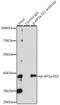 Eukaryotic translation initiation factor 2 subunit 1 antibody, GTX66600, GeneTex, Immunoprecipitation image 