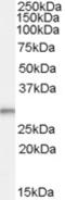 TPD52 Like 2 antibody, TA303279, Origene, Western Blot image 