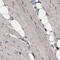 Lysosomal Associated Membrane Protein 1 antibody, AMAb91170, Atlas Antibodies, Immunohistochemistry paraffin image 