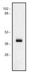 HLA class I histocompatibility antigen, B-27 alpha chain antibody, GTX29090, GeneTex, Western Blot image 