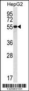 UDP-Glucose 6-Dehydrogenase antibody, 56-538, ProSci, Western Blot image 