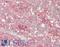 Solute Carrier Family 6 Member 6 antibody, LS-B14573, Lifespan Biosciences, Immunohistochemistry paraffin image 